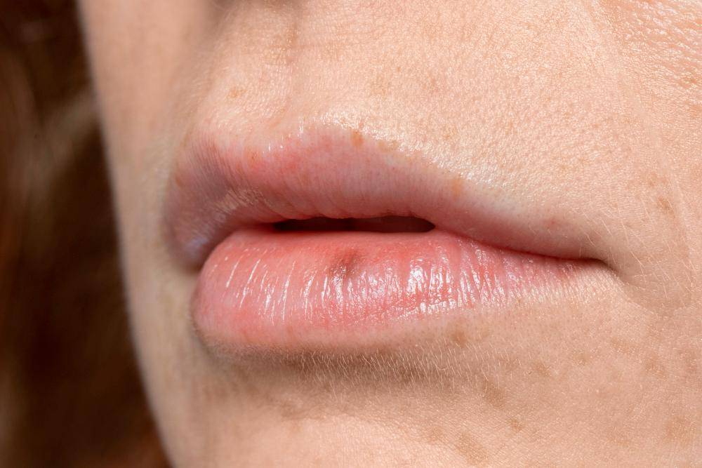 ilustrasi kanker bibir (freepik.com/freepik) 