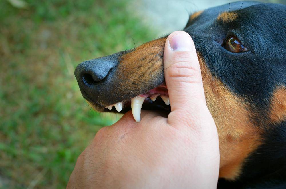 Seekor anjing menggigit tangan orang.