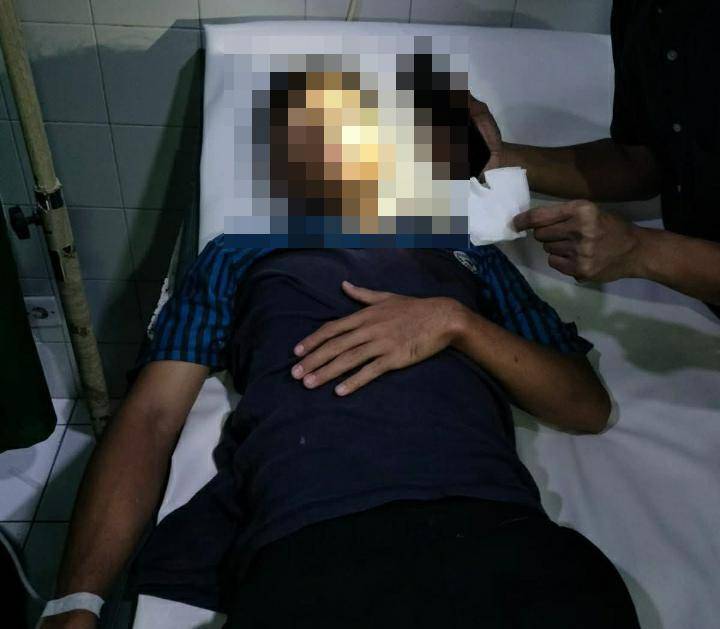 Warga terkena anak panah saat terjadi tawuran atau perang kelompok di Makassar, Senin (22/9/2025)/Istimewa