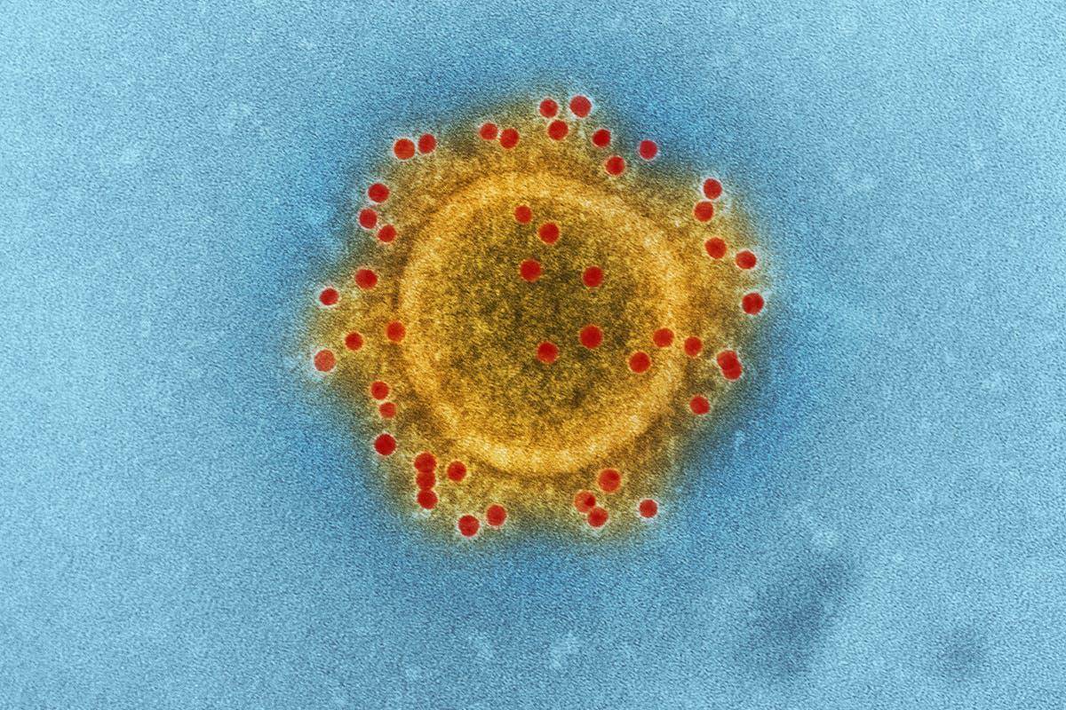 ilustrasi ciri virus (pexels.com/CDC)