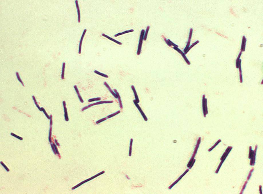 Foto mikrograf Clostridium perfringens.