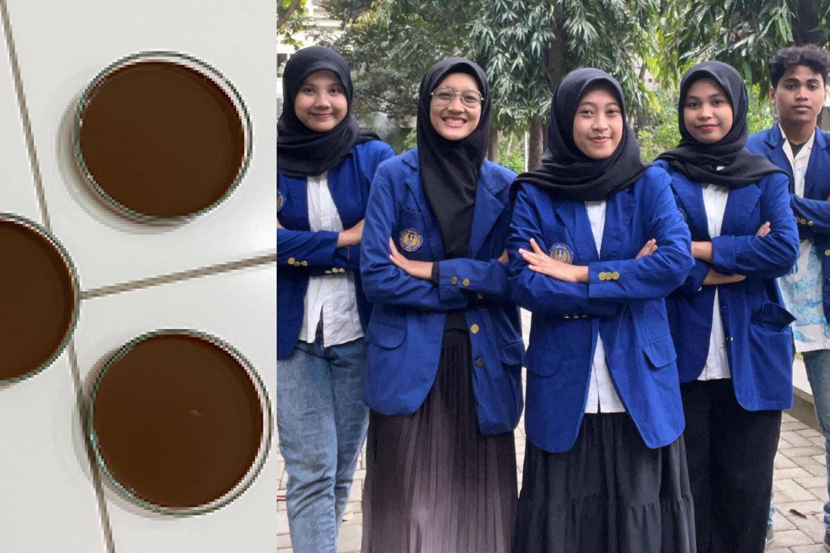 Mahasiswa UNY olah keong macan jadi gel pencegah karies gigi
