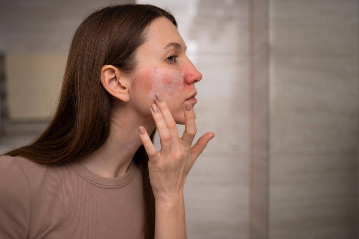 ilustrasi perempuan menggunakan skincare di bagian kulit wajah yang breakout (freepik.com)