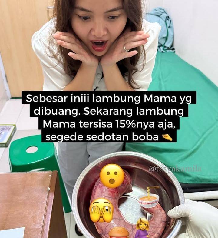 potret mama Tasya Kamila operasi bariatrik 