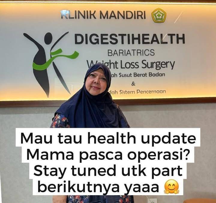 potret mama Tasya Kamila operasi bariatrik 