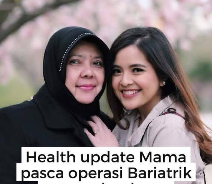 potret mama Tasya Kamila operasi bariatrik 