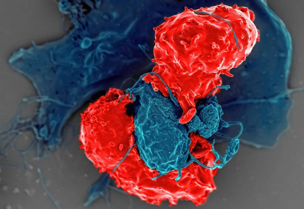 Gambar mikroskop elektron pemindaian menunjukkan sel T regulator (warna merah) yang berinteraksi dengan sel penyaji antigen (antigen-presenting cells, warna biru).