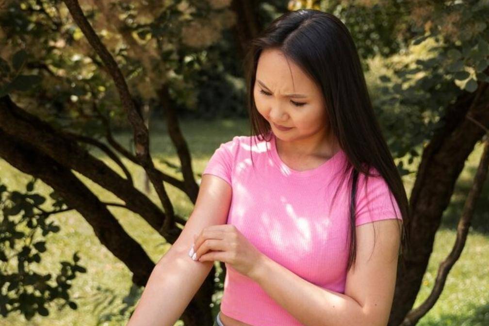 Ilustrasi gatal digigit nyamuk (freepik.com/freepik)