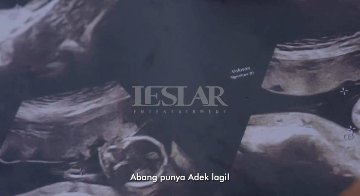 Lesti Kejora umumkan kehamilan anak ketiga 