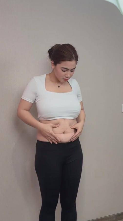 Felicya Angelista Lakukan Sedot Lemak (instagram.com/felicyangelista_)