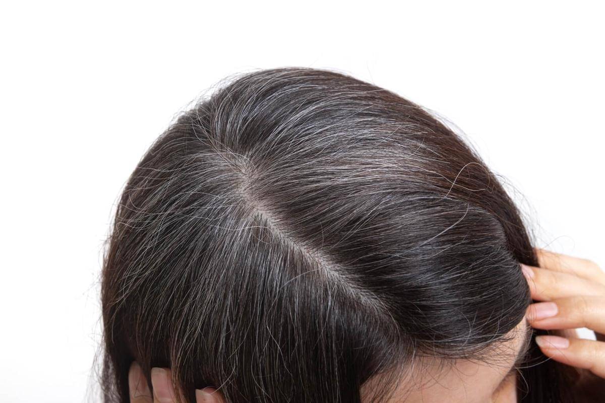 Rambut beruban pada perempuan.