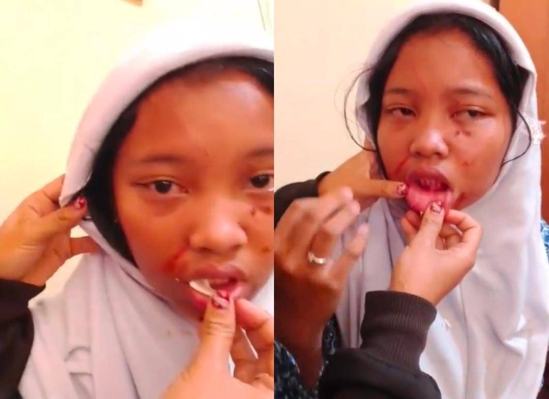 Siswa SMP N 31 Palembang yang diduga dibully (Dok. Tangkapan layar)