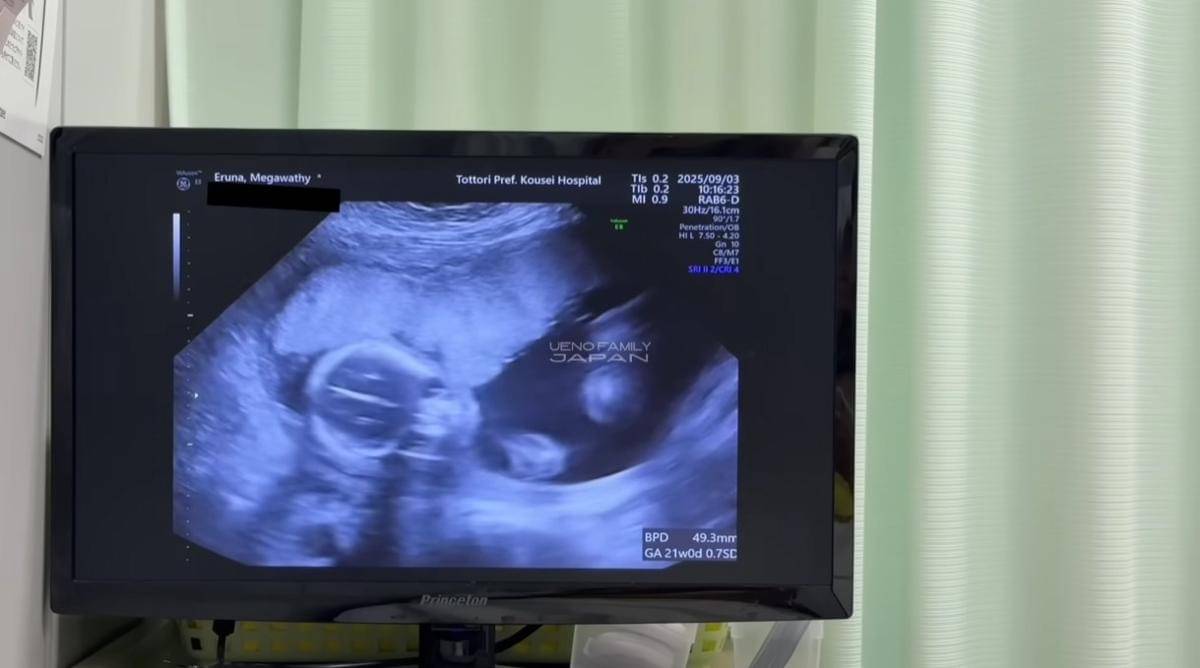 Gender Reveal Kehamilan Uma Mega Ueno Family