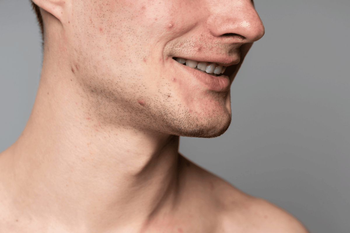 ilustrasi pria dengan kulit wajah kusam