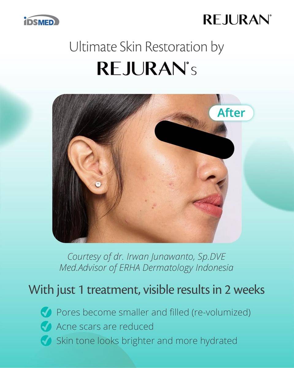 Untuk Poin 2 - ✨ Ultimate Skin Restoration by Rejuran S ✨  Hanya dengan 1x treatment, hasil nyata dapat terliha 2.jpg