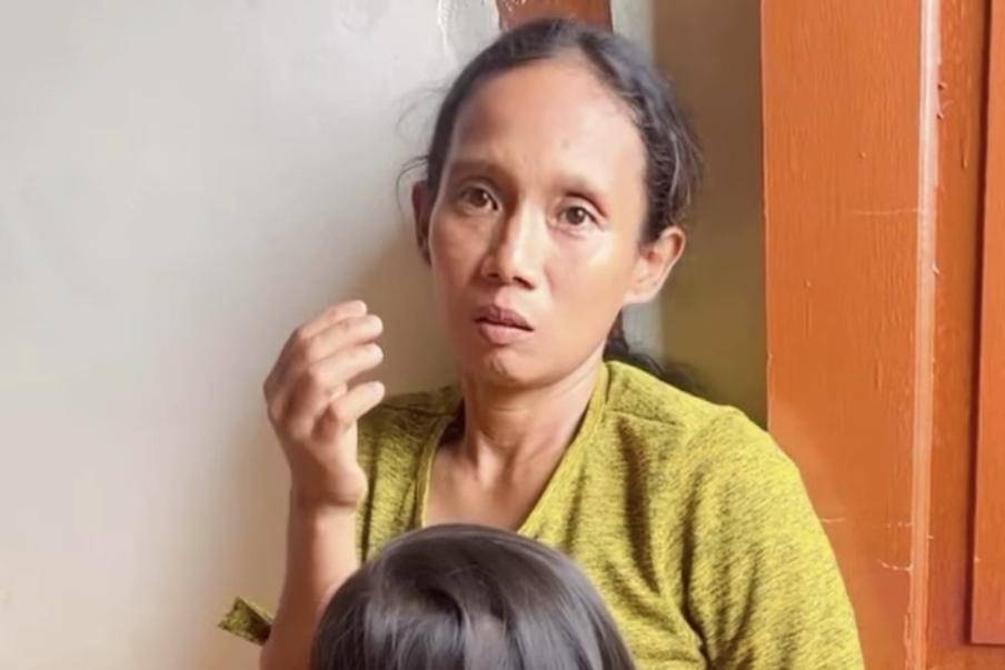 Siswa sd di Palembang alami lebam di mata dan mata memerah diduga akibat penganiayaan di sekolah.