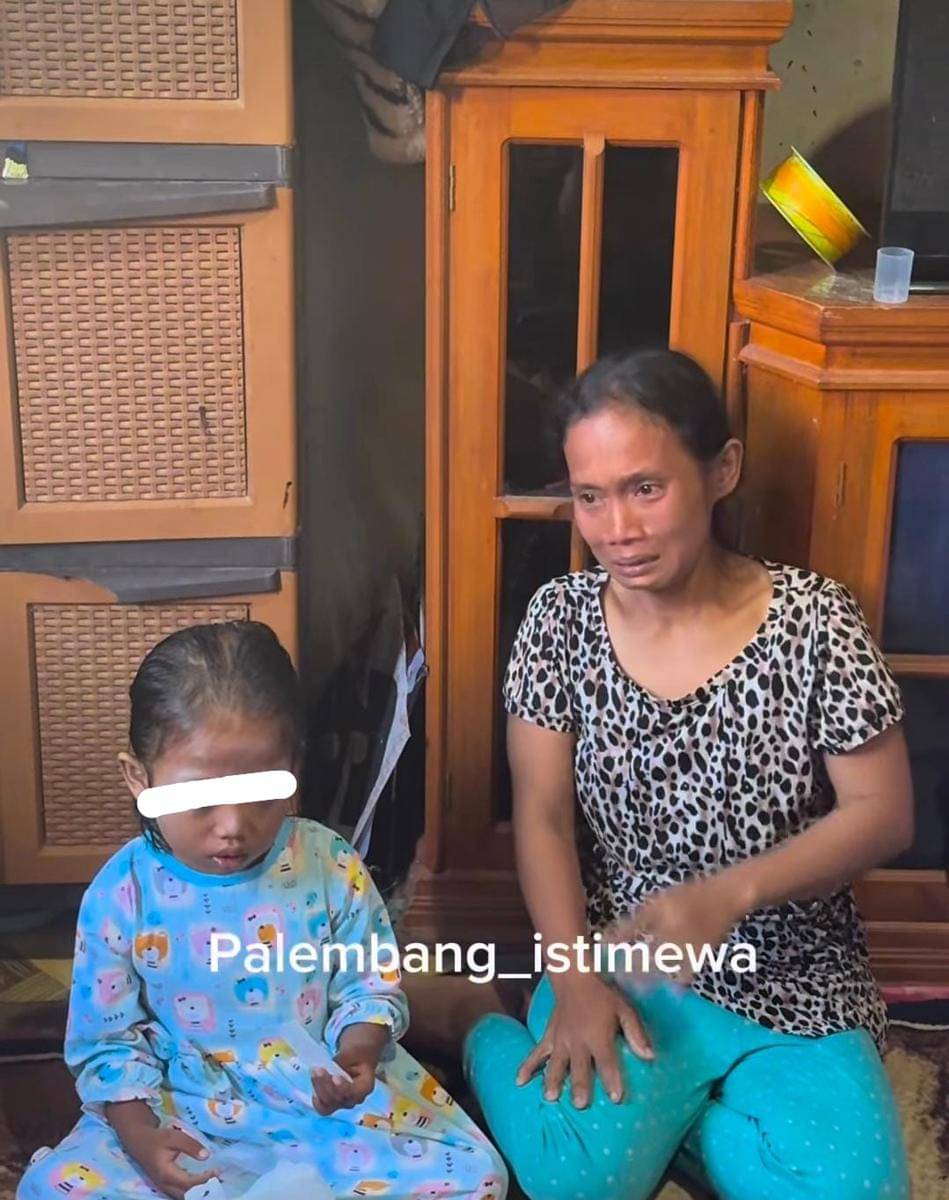 Siswi mata lebam di Palembang (tangkapan layar)