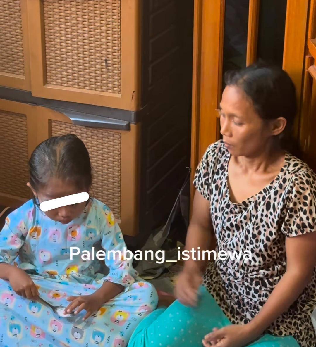 Siswi mata lebam di Palembang (tangkapan layar)