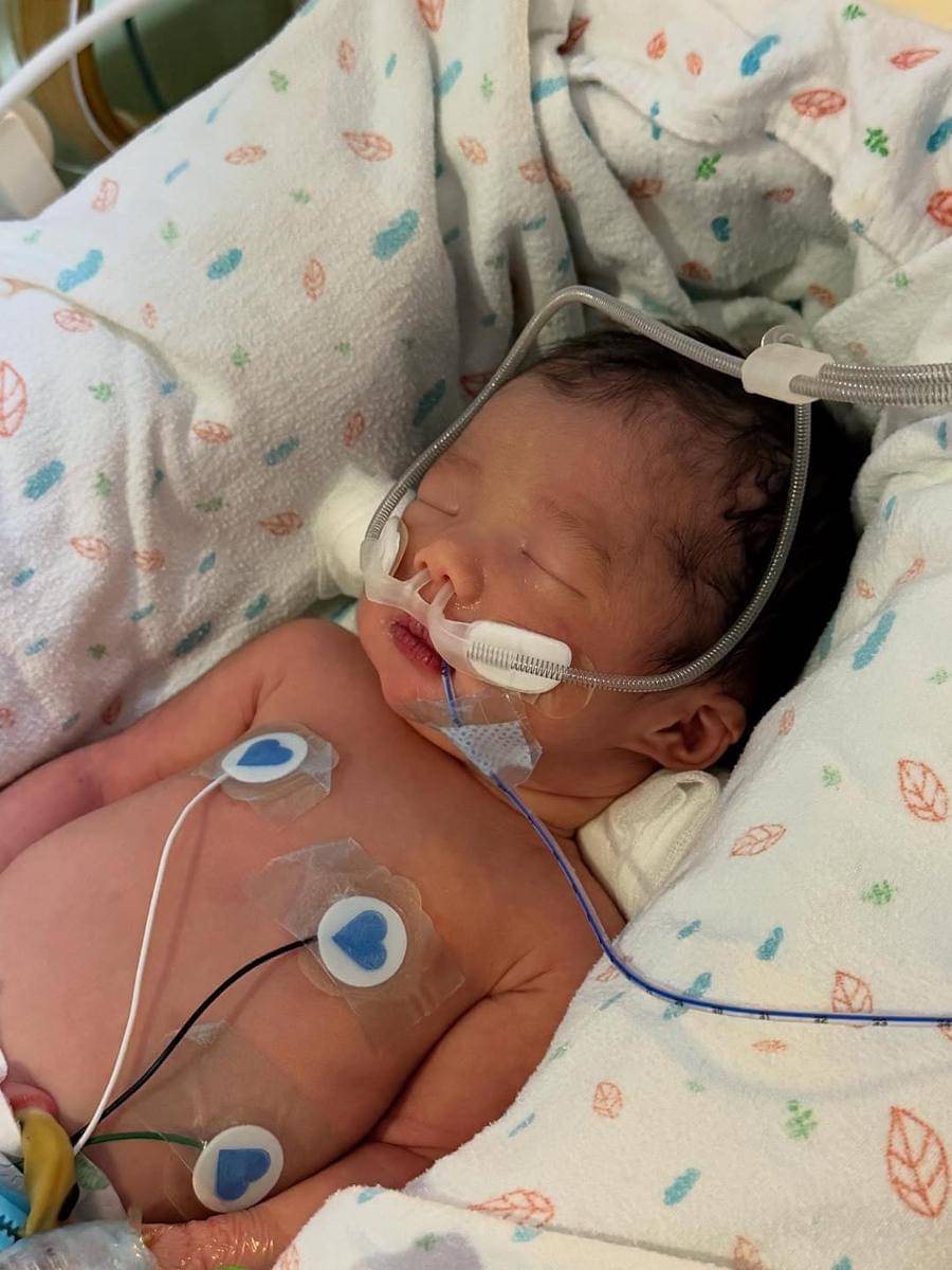 Potret momen Lee Si Young melahirkan anak kedua