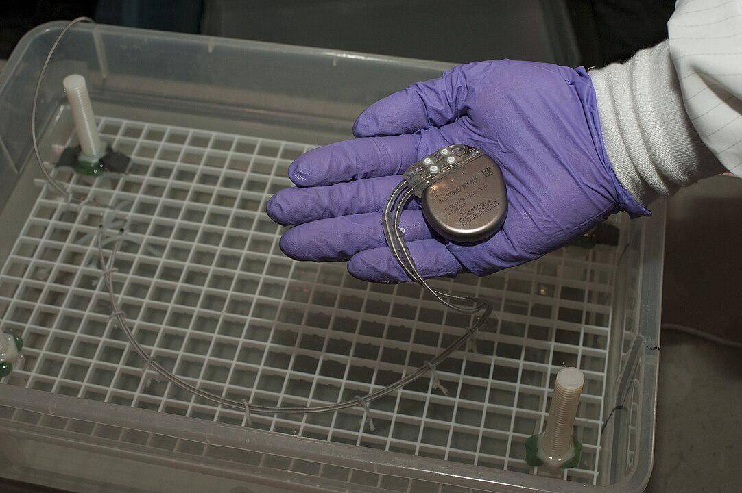 ilustrasi alat pacu jantung