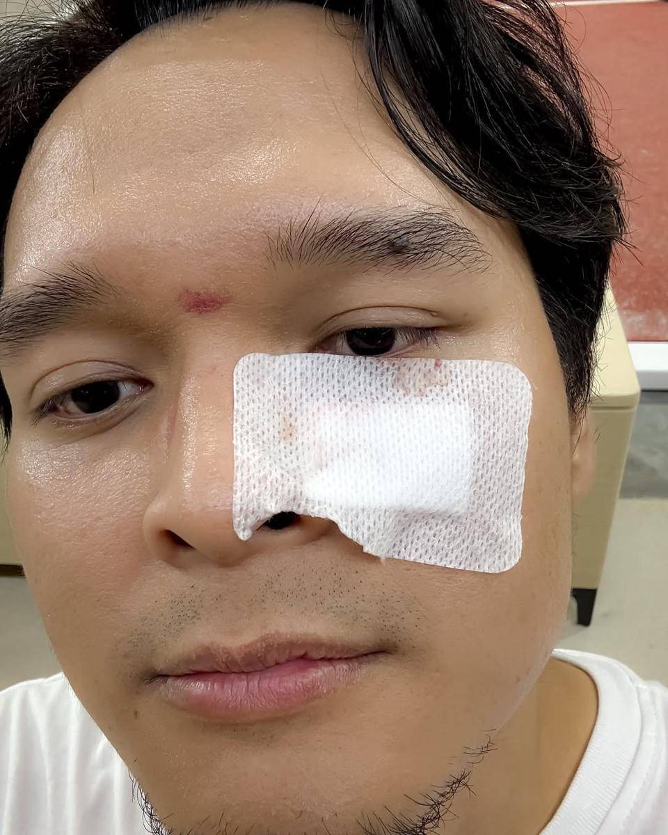 Anisa Rahma dan Dito raih kejuaraan padel