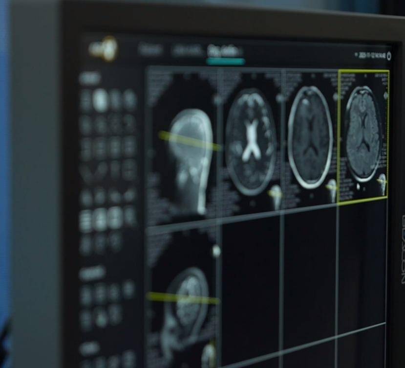 RS Marinir Cilandak Kini Dibekali MRI Canggih, Permudah Berobat