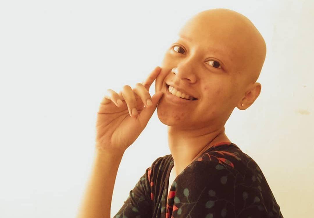 Penyintas alopecia universalis dan pendiri komunitas Alopecia Friend for Indonesia (AFFI), Hanna Nugrahani (33). (Dok. Pribadi)