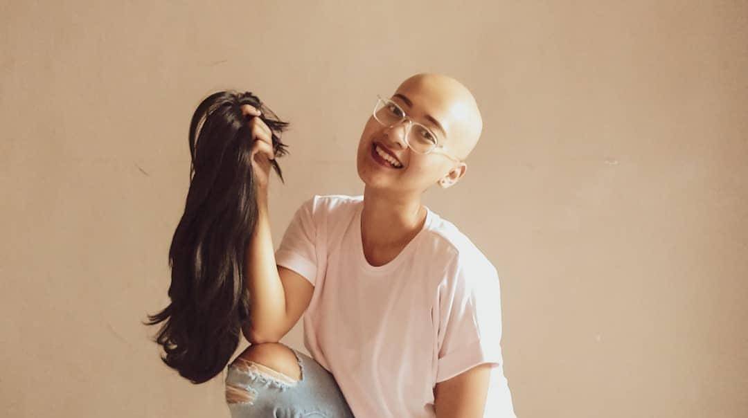 Penyintas alopecia universalis dan pendiri komunitas Alopecia Friend for Indonesia (AFFI), Hanna Nugrahani (33). (Dok. Pribadi)