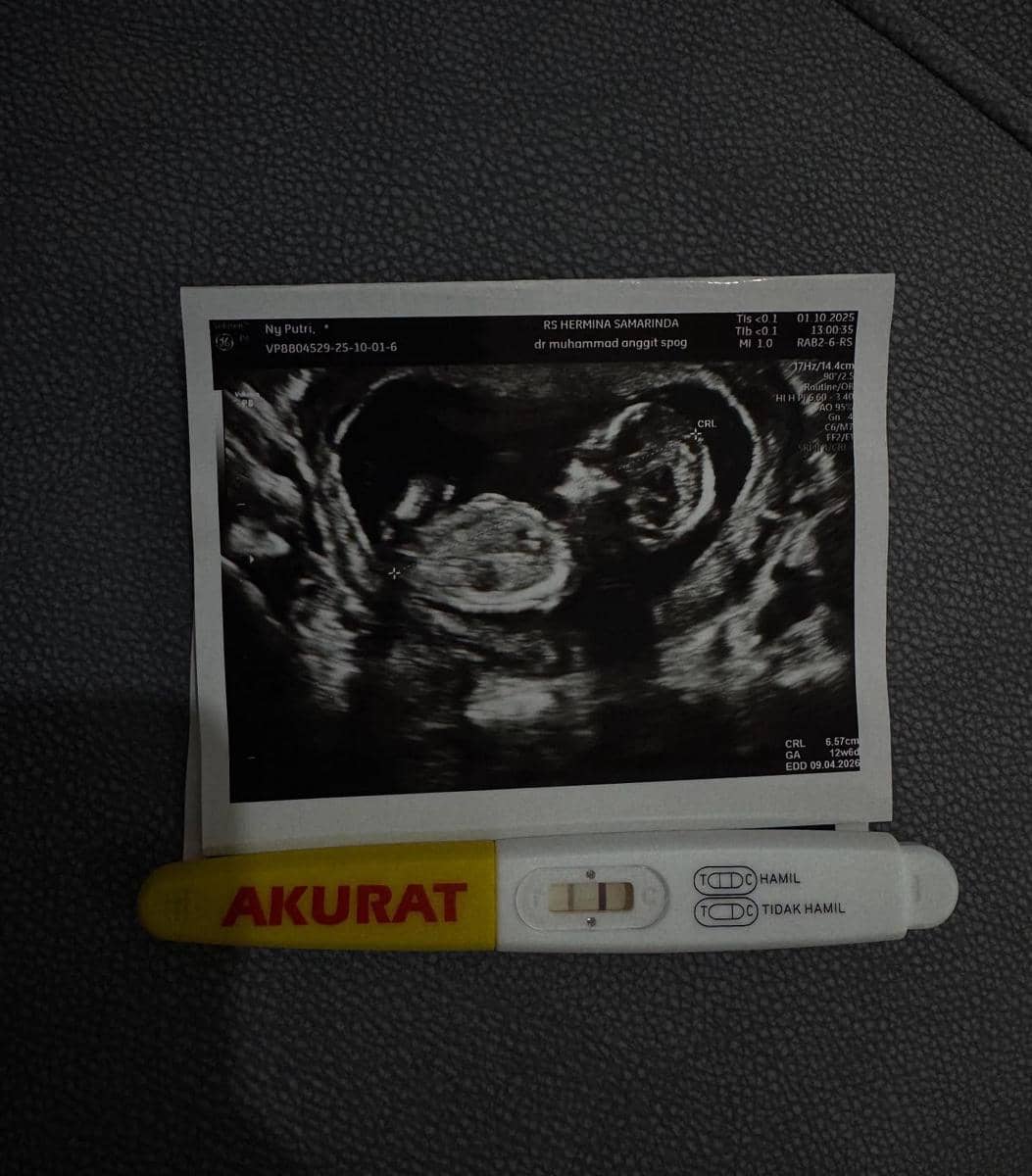 Pemotretan Maternity Putri Isnari (instagram.com/putriisnari3)