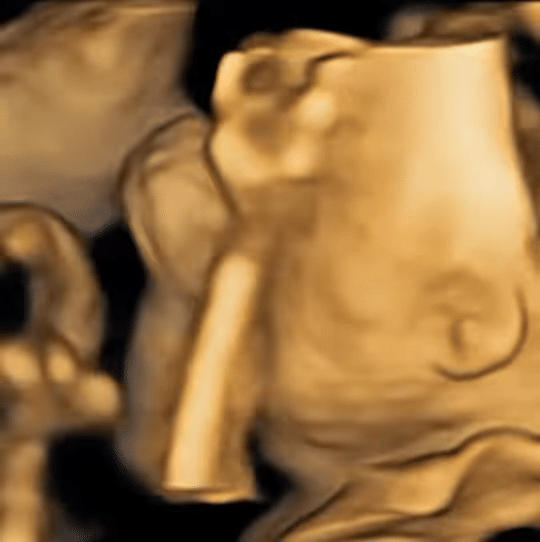 potret ulang tahun Nino RAN (instagram.com/ninokayam)