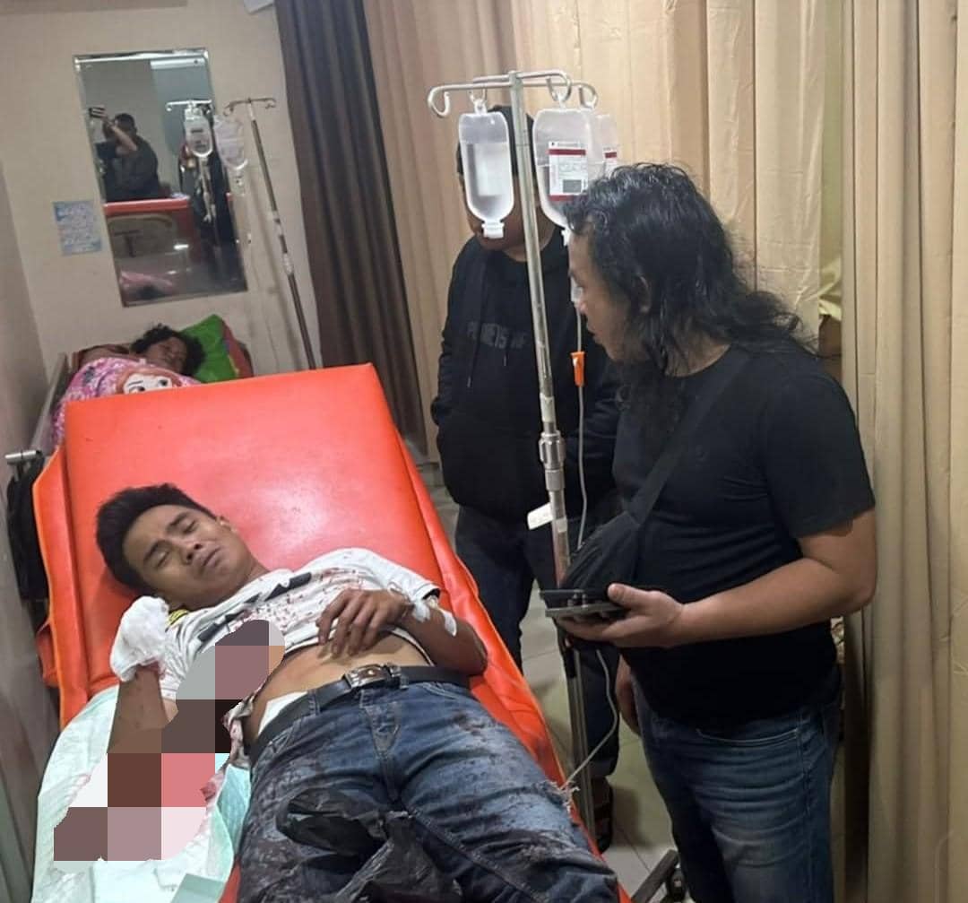 Pelaku pencurian di Lubuk Linggau saat dirawat di RS AR Bunda karena tangannya putus.