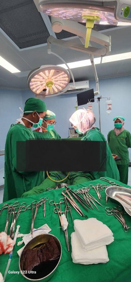 Tim medis Unhas saat lakukan proses operasi ibu hamil korban bencana di Aceh, Rabu (3/12/2025). Dok. Humas Unhas