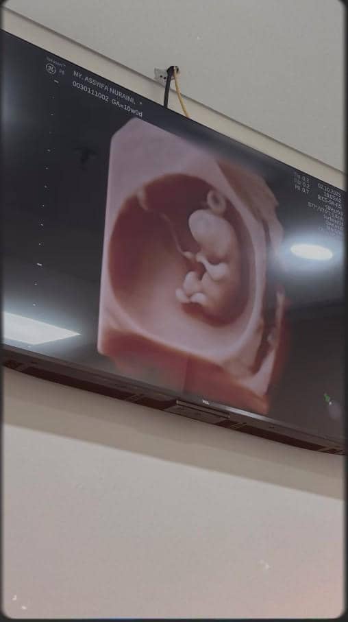 Adik Ayu Ting Ting Umumkan Kehamilan Ketiga (instagram.com/syifaasyifaaa)