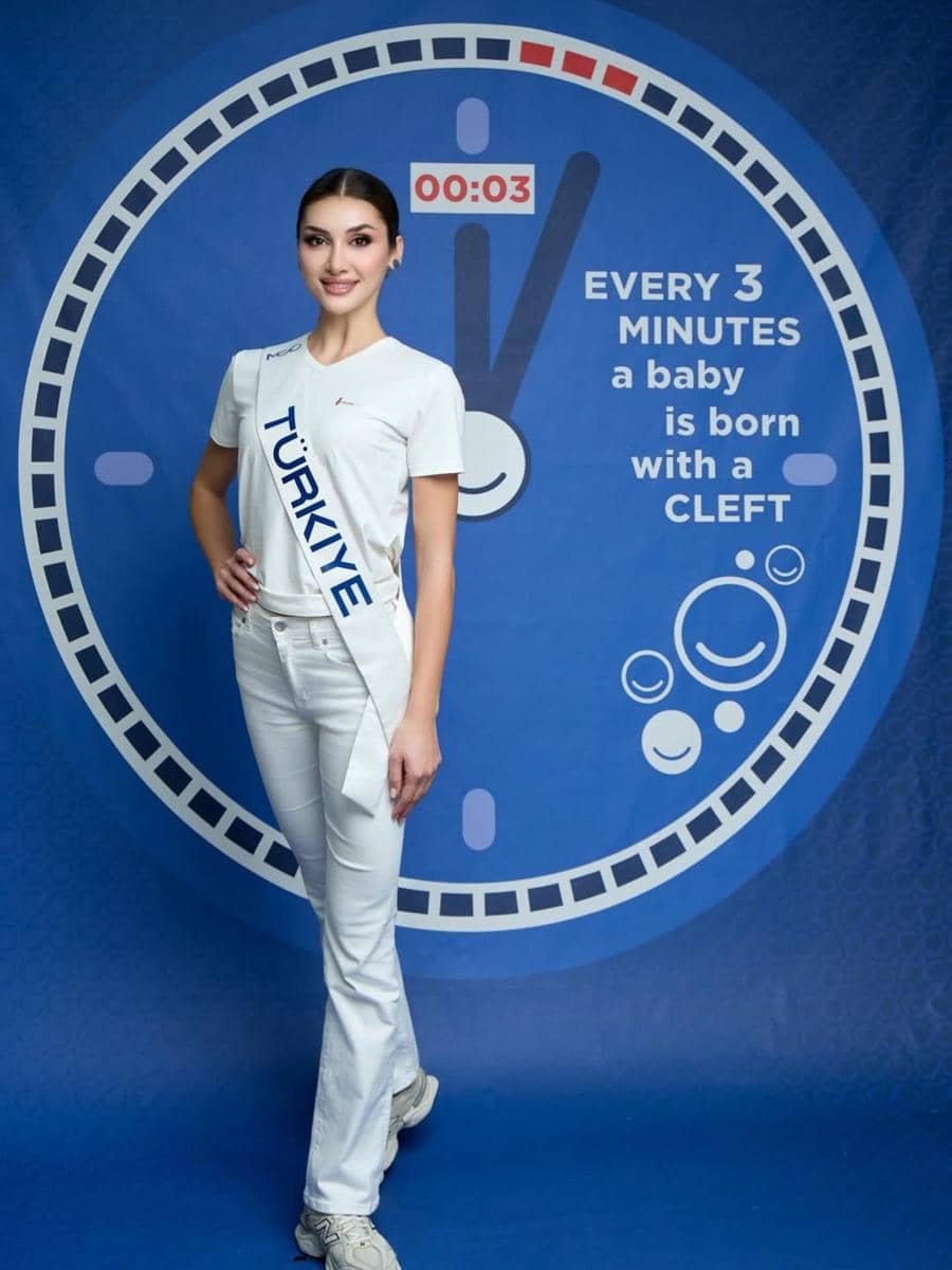 potret Huray Erturk, Miss Cosmo Turki 2025