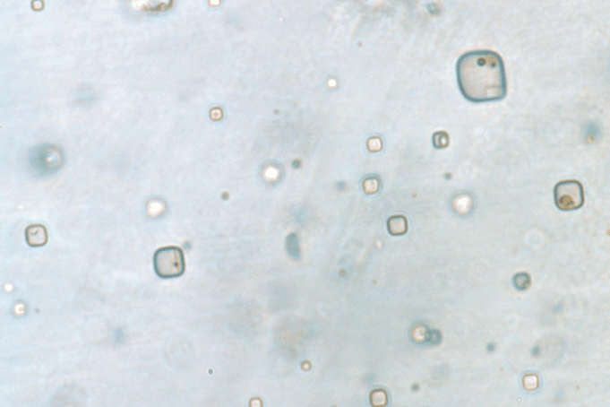 Mikroba garam Australia