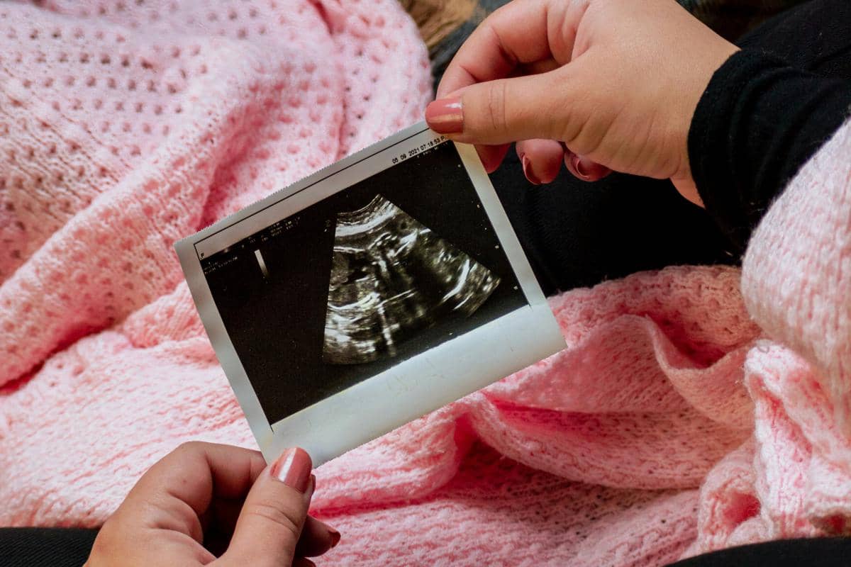 Foto USG kehamilan.