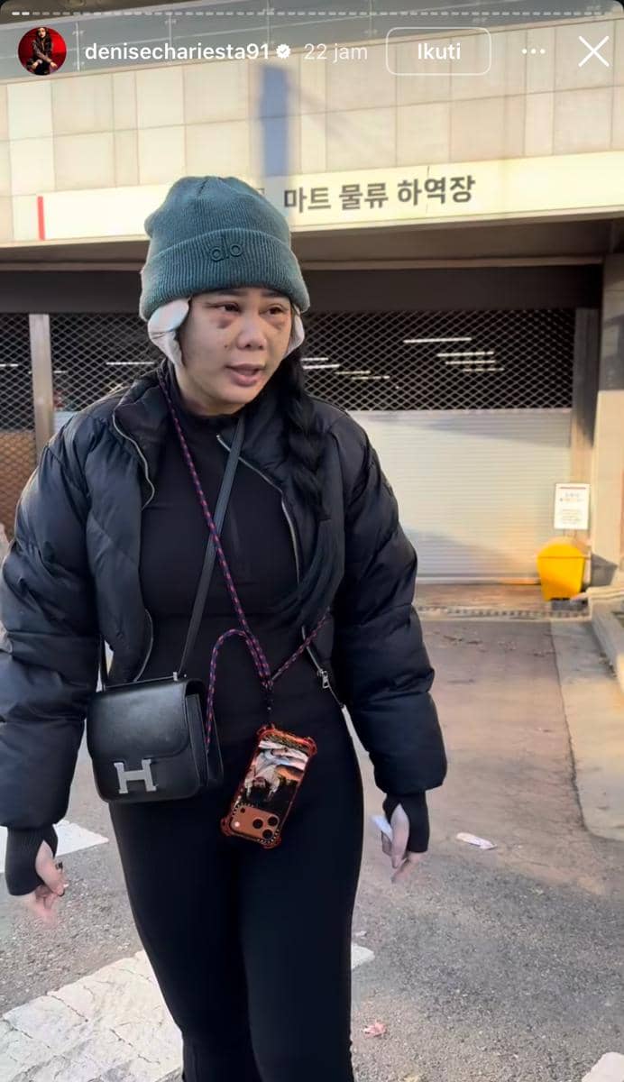 potret Denise Chariesta operasi plastik