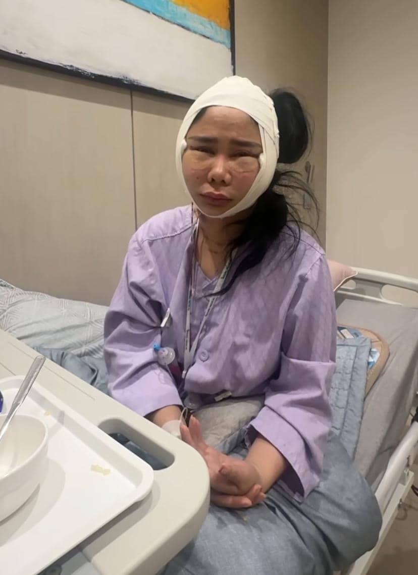 potret Denise Chariesta operasi plastik