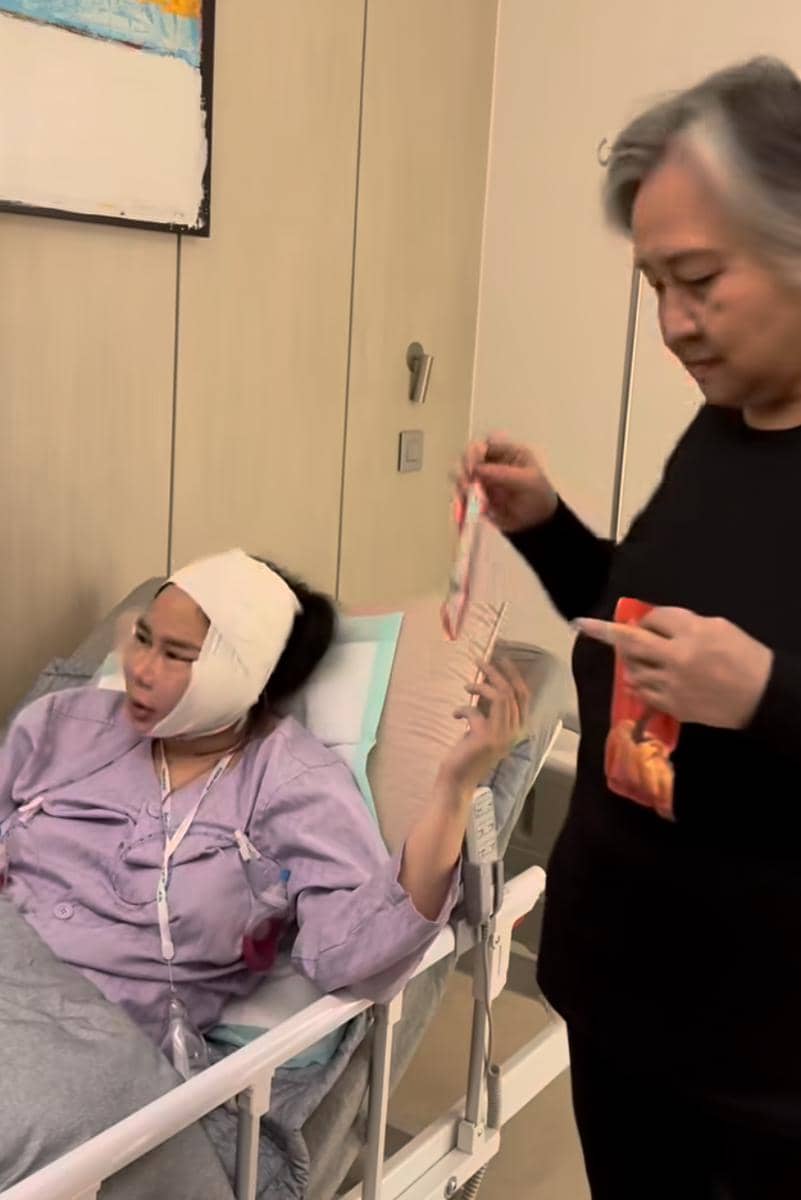 potret Denise Chariesta operasi plastik