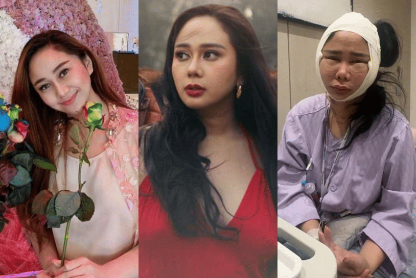 potrer Denise Chariesta