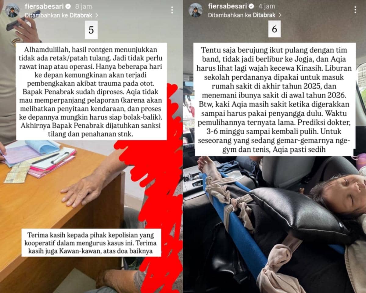 Kronologi istri Fiersa Besari ditabrak mobil dari belakang