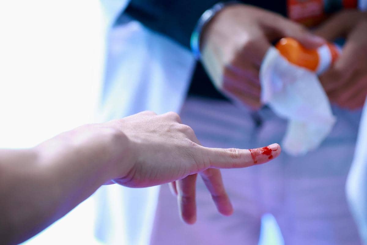 Jari Jonatan Christie sempat terluka saat berlaga di 16 besar India Open 2026 