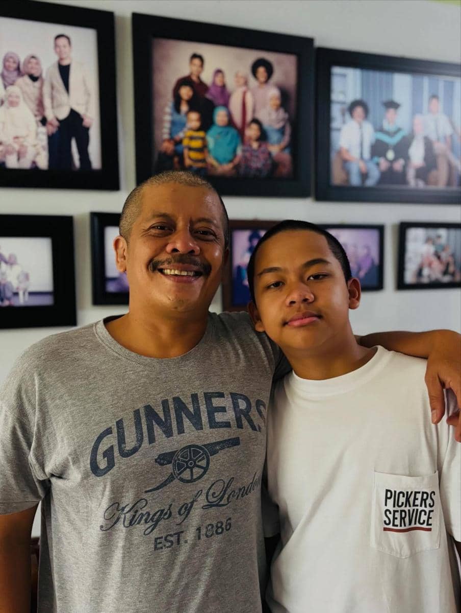 Eddi Brokoli usai Cukur Gundul (instagram.com/eddibrokoli)