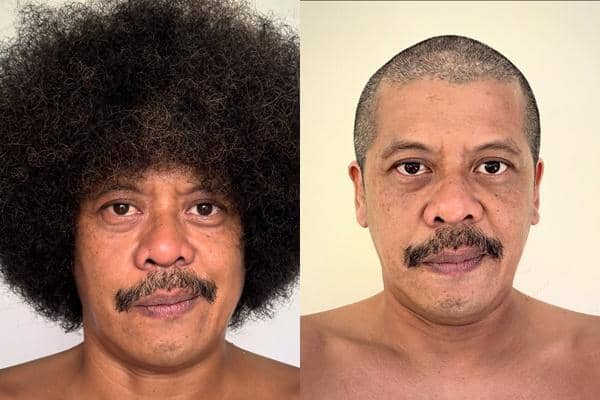 Eddi Brokoli usai Cukur Gundul (instagram.com/eddibrokoli)