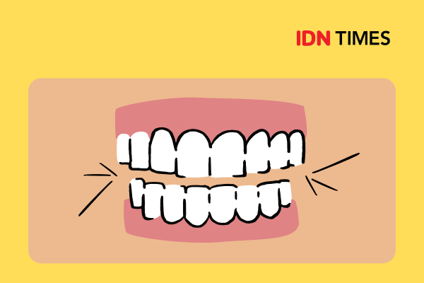 Ilustrasi bruksisme atau menggemeretakkan gigi.