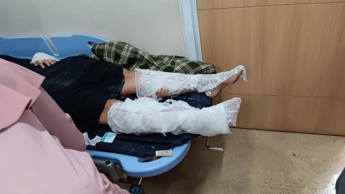 Korban ledakan tabung gas di Palembang