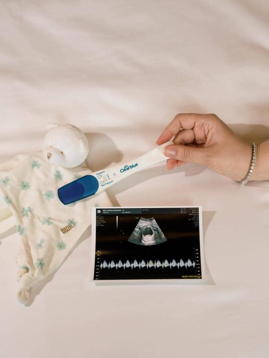 Chelsea Islan Umumkan Kehamilan 