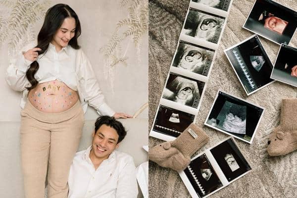 Chelsea Islan Umumkan Kehamilan