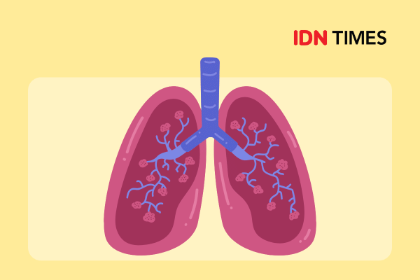 Ilustrasi paru-paru.