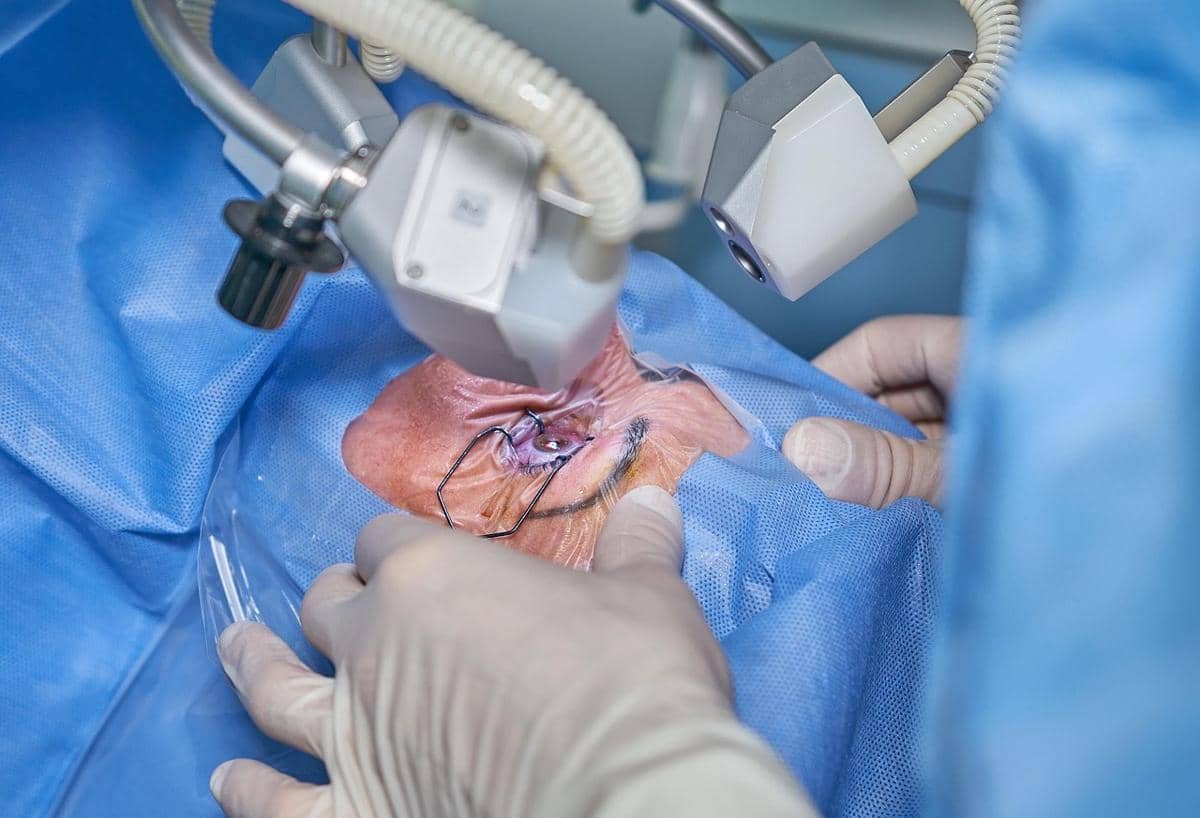 Dokter sedang melakukan operasi mata.